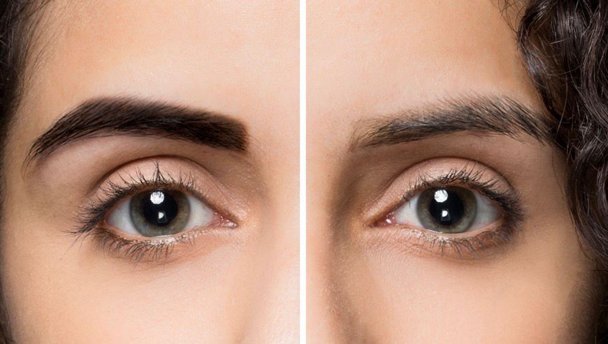 Curso de Despigmentação Química e Contorno de Olhos