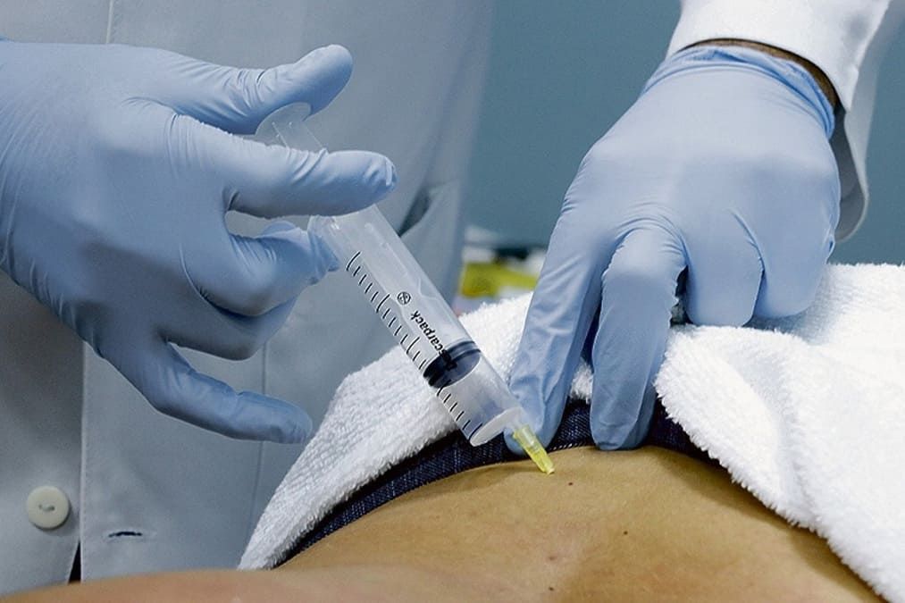 Curso de Intradermoterapia Injetada