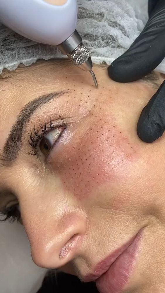 Curso de Jato de Plasma